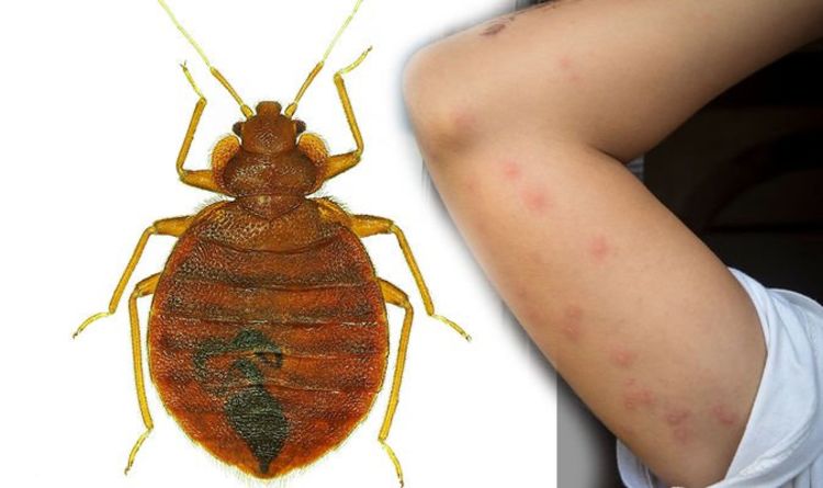 bedbugs treatment
